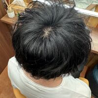画像1487：円形脱毛をシルエクステでカバー例です