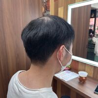 画像1489：円形脱毛をシルエクステでカバー例です