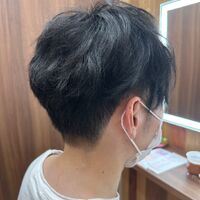 画像1490：円形脱毛をシルエクステでカバー例です