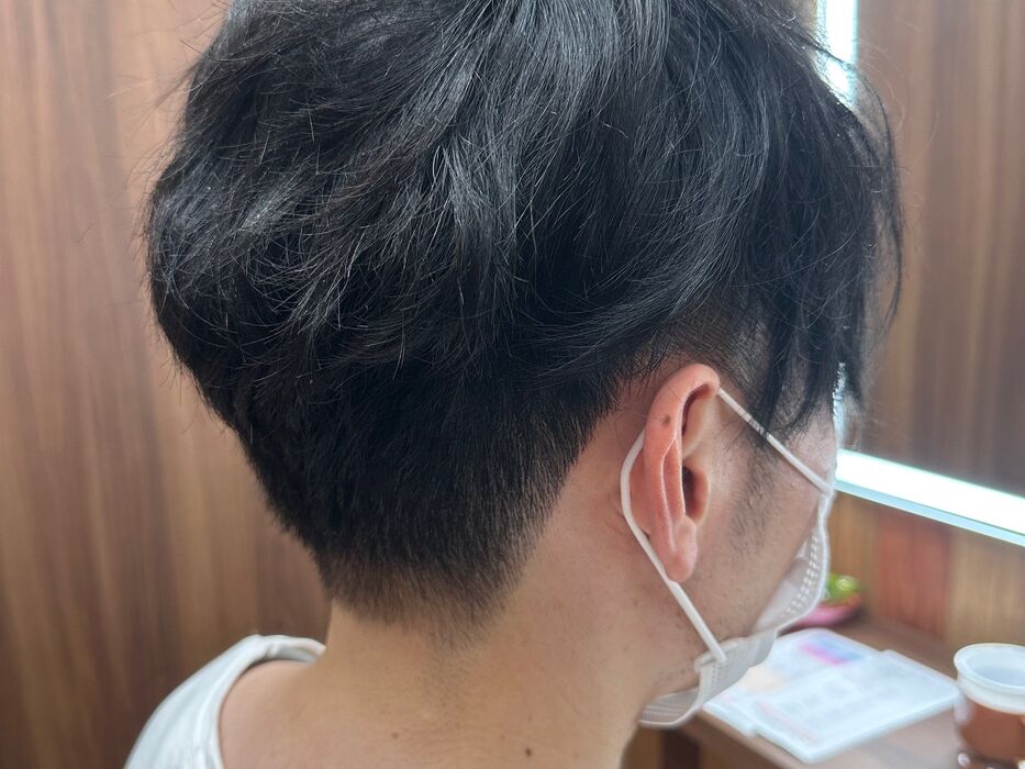 画像1490：円形脱毛をシルエクステでカバー例です
