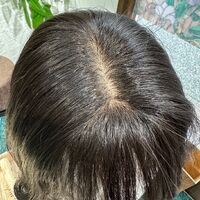 画像1524：円形脱毛をシルエクステでカバー例です