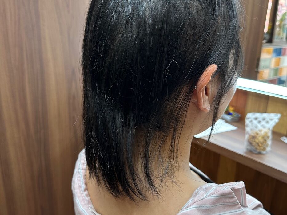 画像1528：円形脱毛をシルエクステでカバー例です