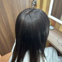 画像2133：円形脱毛をシルエクステでカバー例です