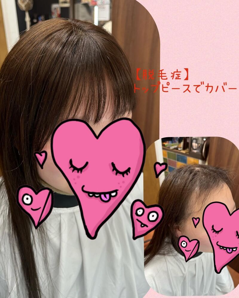 ブログ画像